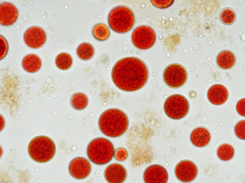 Haematococcus pluvialis — the deep-red, astaxanthin-rich Hawaiian microalgae, magnified